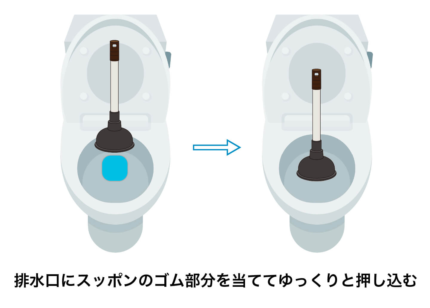 ラバーカップ使用方法